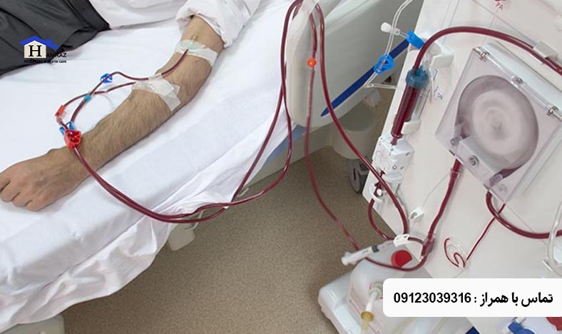 دیالیز کبد در منزل