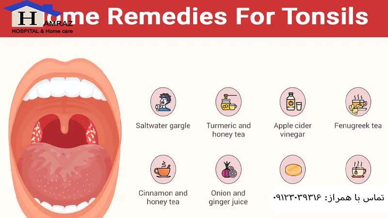 درمان التهاب لوزه در منزل