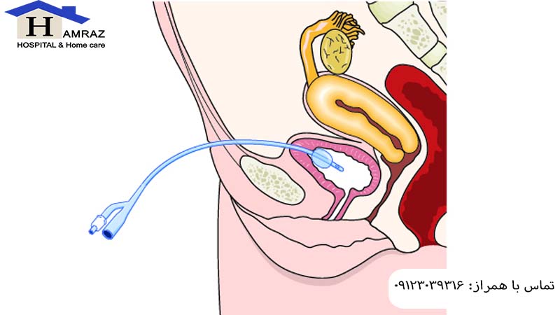 سوند سوپراپوبیک