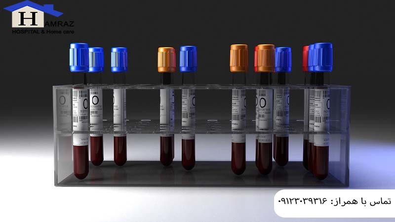 آزمایش در منزل سعادت آباد