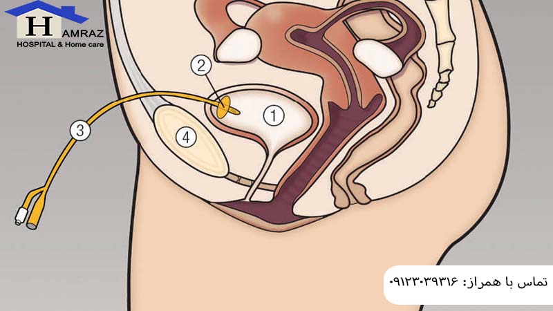 سوند سوپراپوبیک