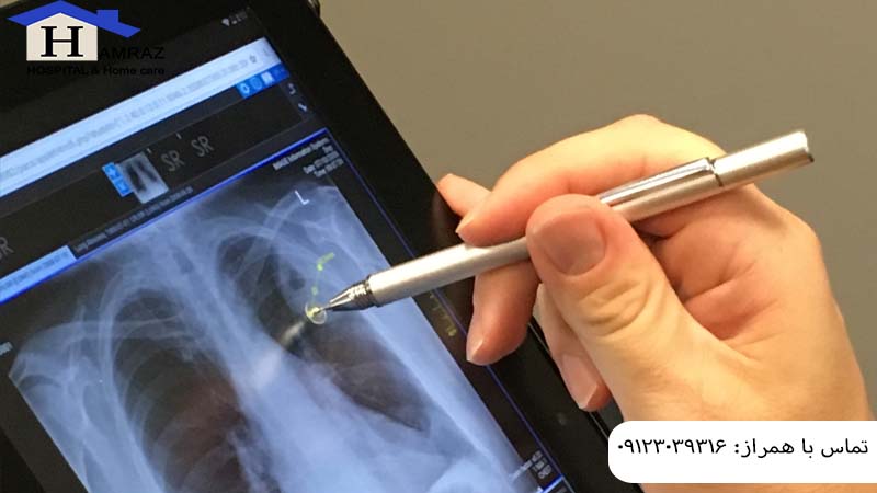 رادیولوژی در منزل تجریش