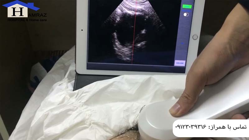 رادیولوژی در منزل تجریش