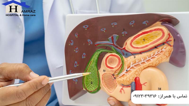 انسداد مجرای صفراوی