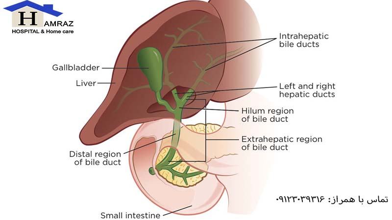 انسداد مجرای صفراوی