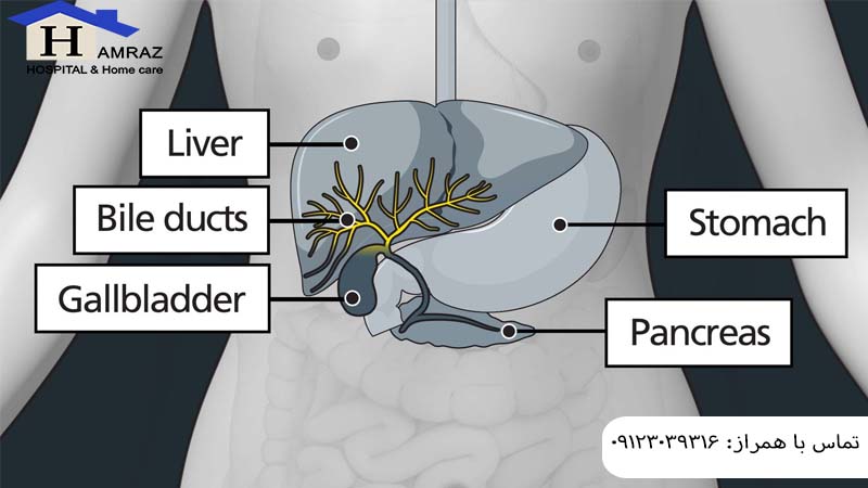 انسداد مجرای صفراوی
