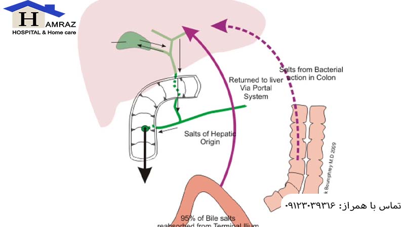 انسداد مجرای صفراوی